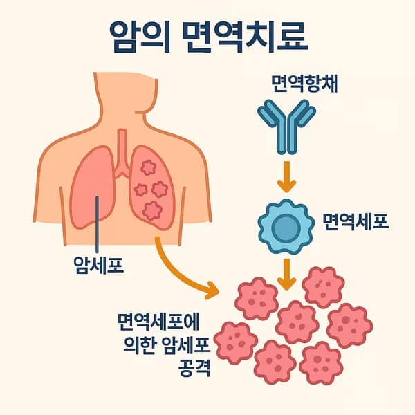 면역요법과 암: 암세포와의 전투를 위한 면역 체계 강화