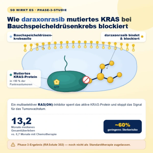 Daraxonrasib-Pillenmolekül bindet an KRAS-Protein in einer Pankreaskrebszelle.