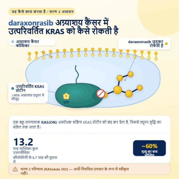 अग्नाशय कैंसर कोशिका में KRAS प्रोटीन से जुड़ने वाले डैराक्सोनरासिब गोली अणु का वैचारिक चित्रण।
