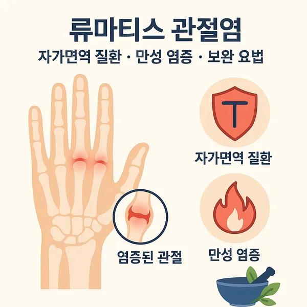 류마티스 관절염: 자가면역 질환 및 치료 접근법