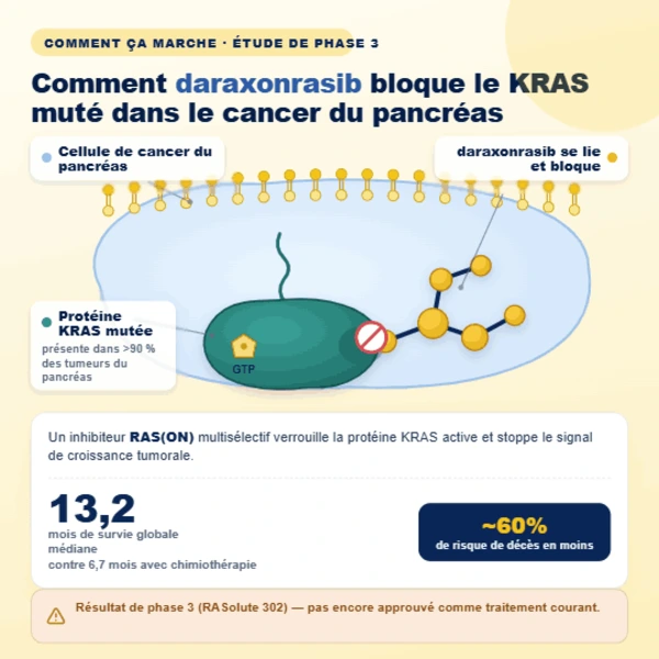 Molécule de daraxonrasib se liant à une protéine KRAS dans une cellule de cancer du pancréas.